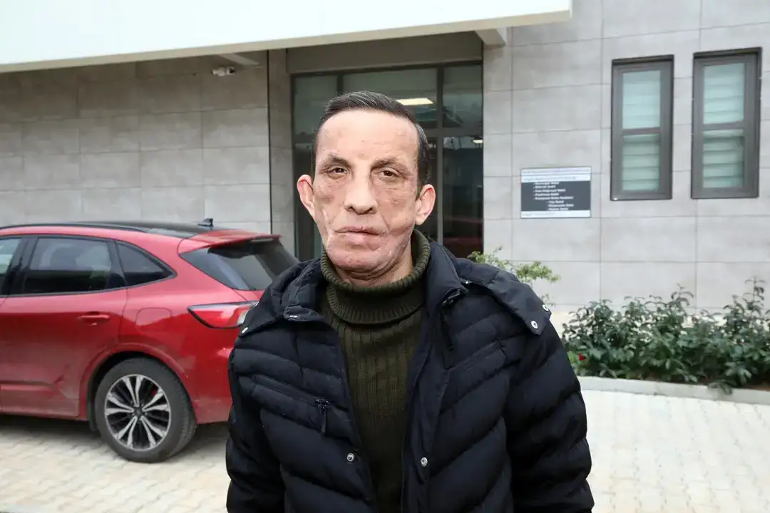 Manavgatlı Uğur Acar: 'Yüzünü Aldığım Kişinin Yaşındayım' 9